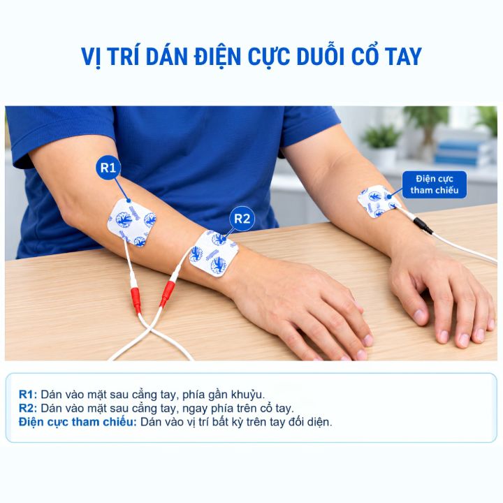Vị trí dán điện cực duỗi cổ tay