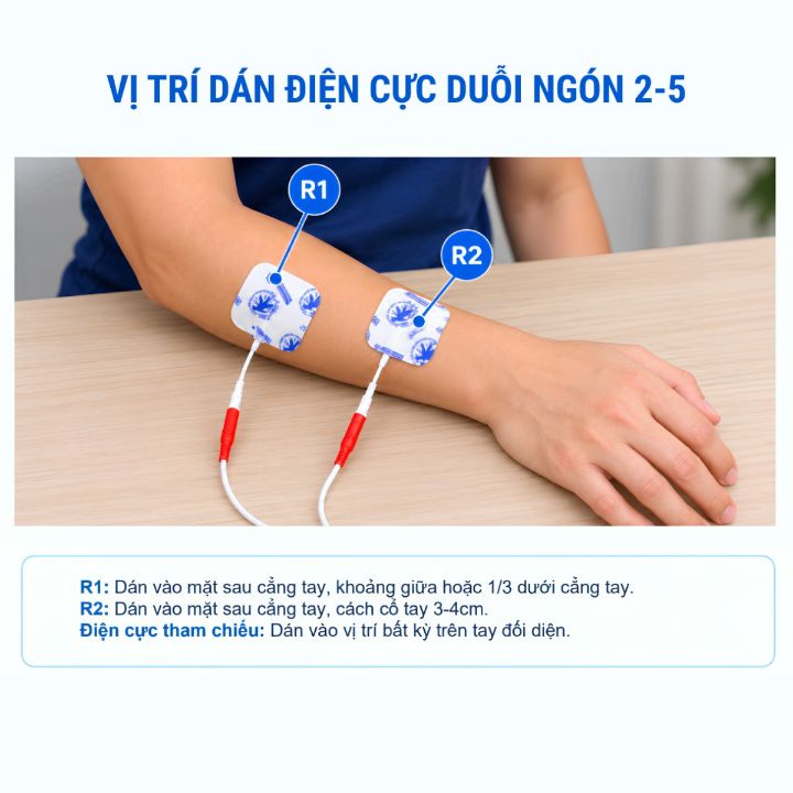 Vị trí dán điện cực duỗi ngón 2-5