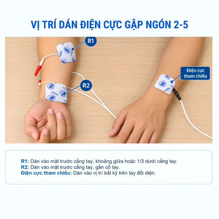 Vị trí dán điện cực gập ngón 2-5